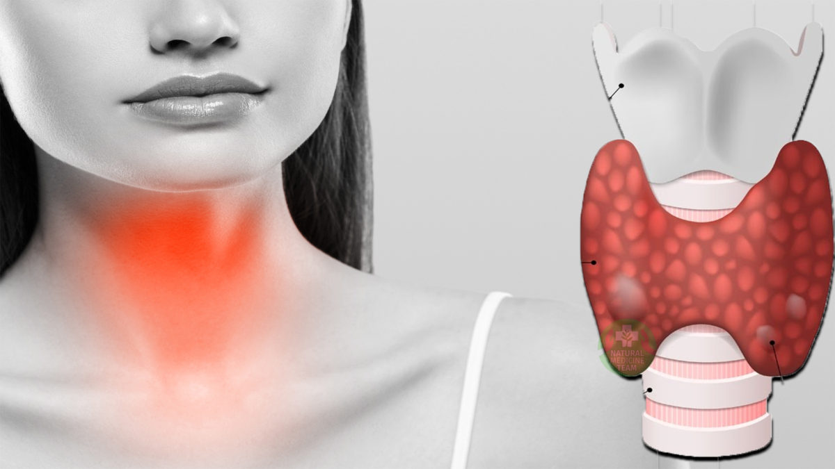 7 Foods Rich In Iodine For Your Thyroid Gland – Top Natural Remedy