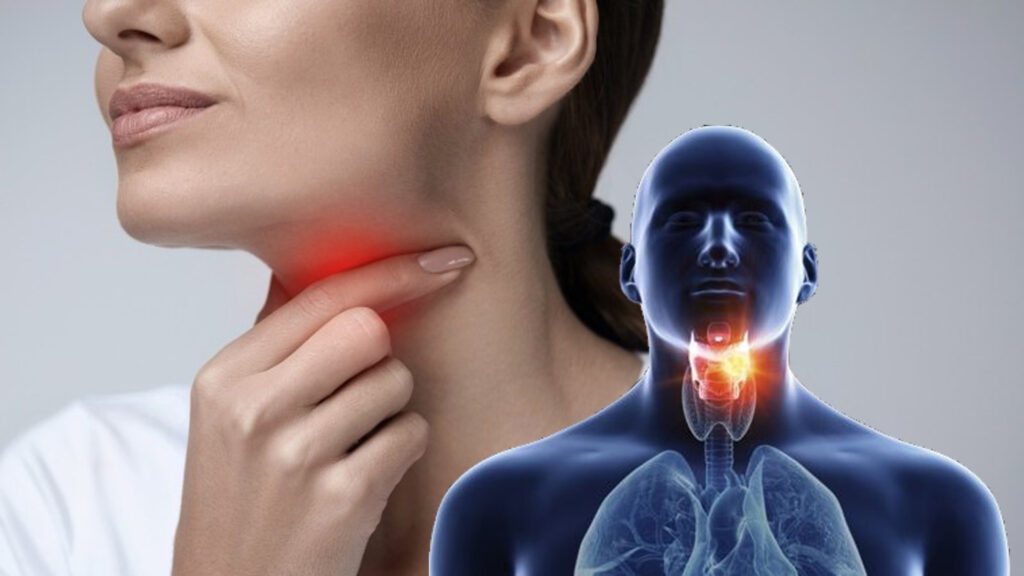 sore throat Remedies 